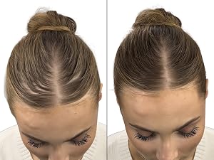 Root touch up before after 3
