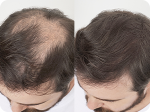 Hair Thickening Fibers