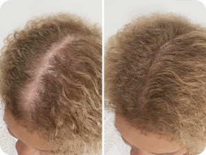 Hair Thickening Fibers