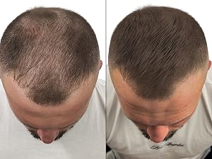 Dark Brown Root Touch Up Powder before after 7