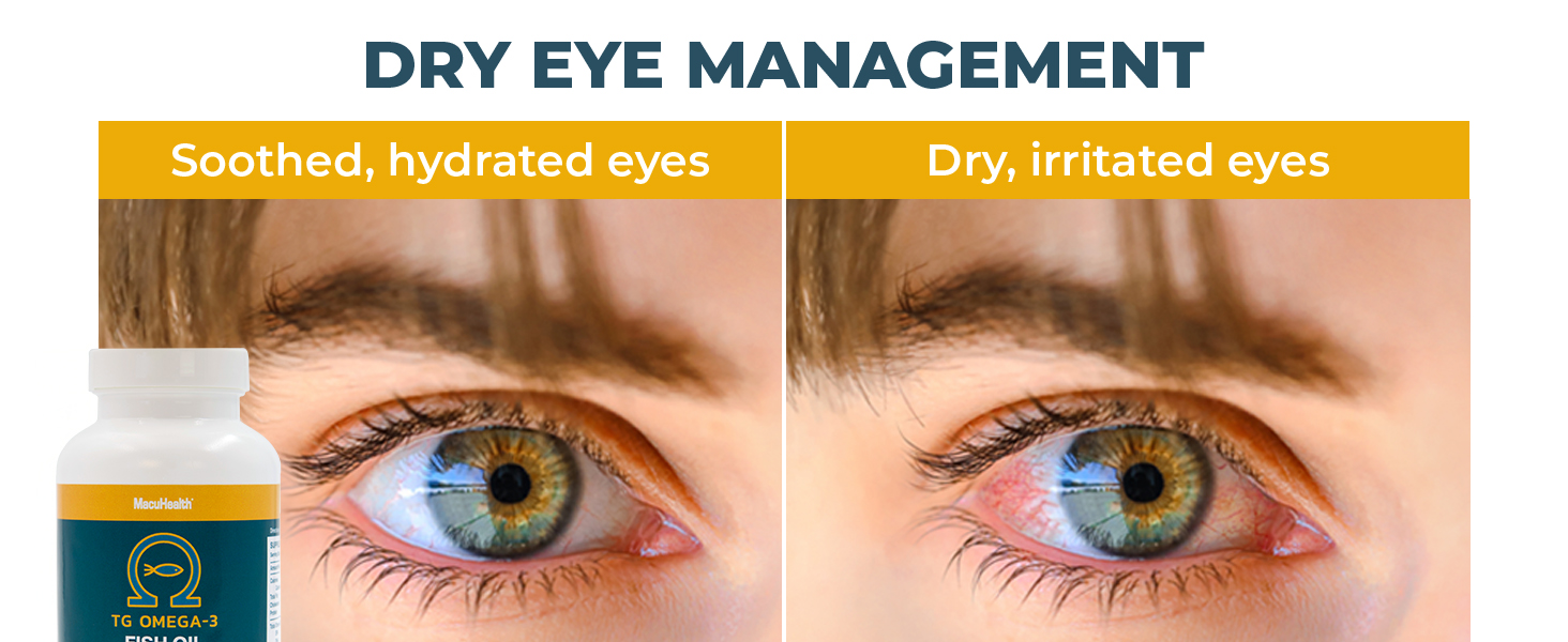 omega support dry pack eye emulsion dha epa omega3 fish oil mg health formula omega-3